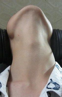 oya2