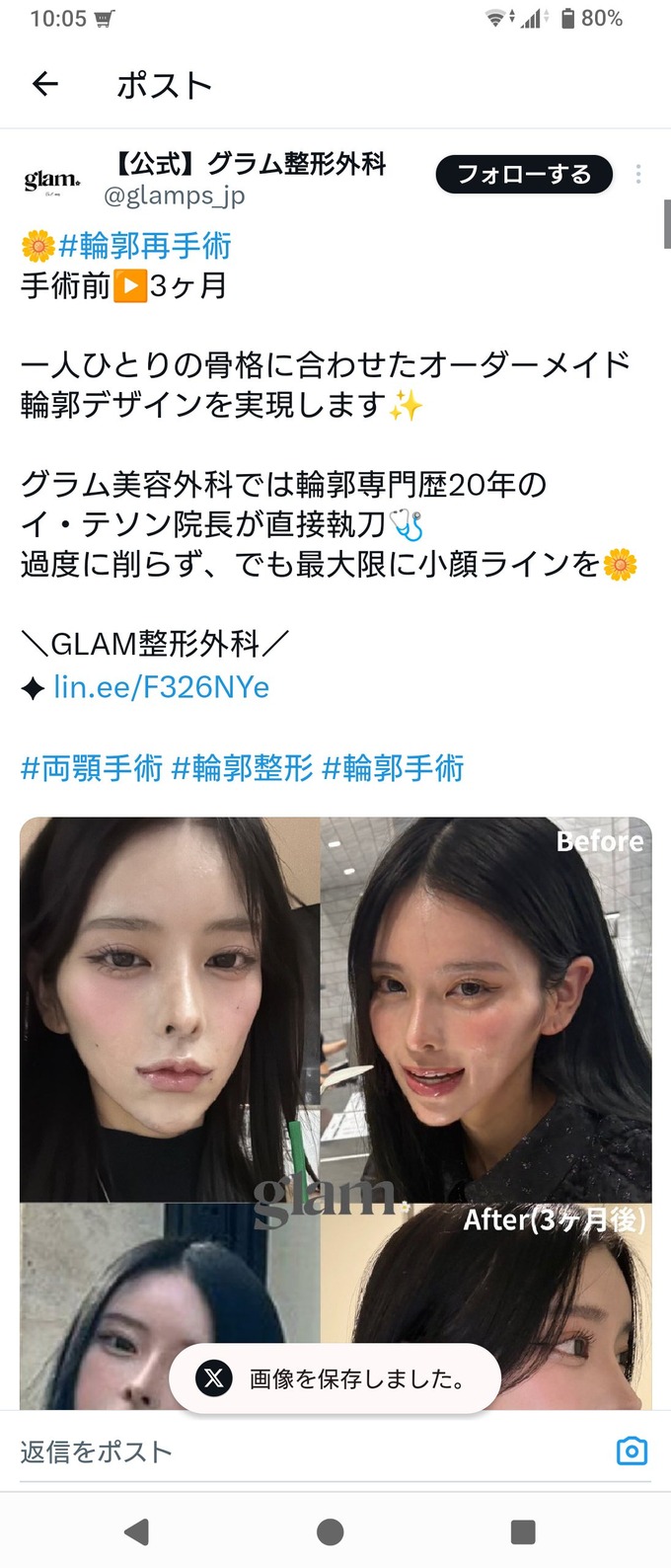 最新の整形技術、すごすぎる