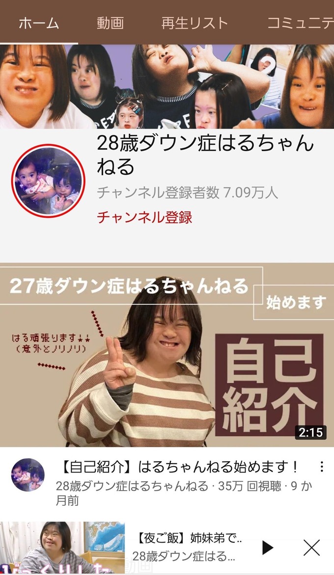 もみあげチャ シュ 朗報 ダウン症youtuber がめちゃくちゃ可愛いと話題に ライブドアブログ もみあげチャ シュ 朗報 ダウン症youtuber がめちゃくちゃ可愛いと話題に ライブドアブログ