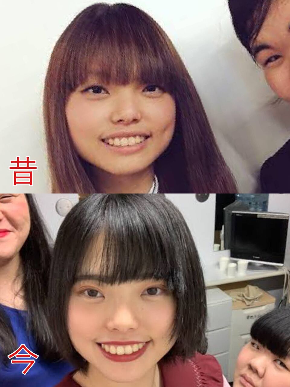 画像あり 人気女芸人さん 整形していた 男は結局見た目で判断 昔からコンプレックスだった Sakamobi Com