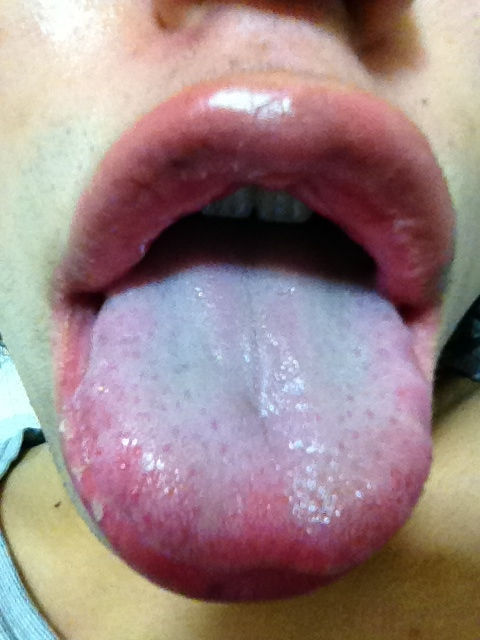 kissgao4