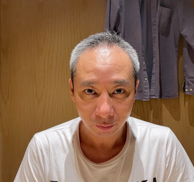 【朗報】いしだ壱成(50)、植毛成功でめちゃくちゃ若返る