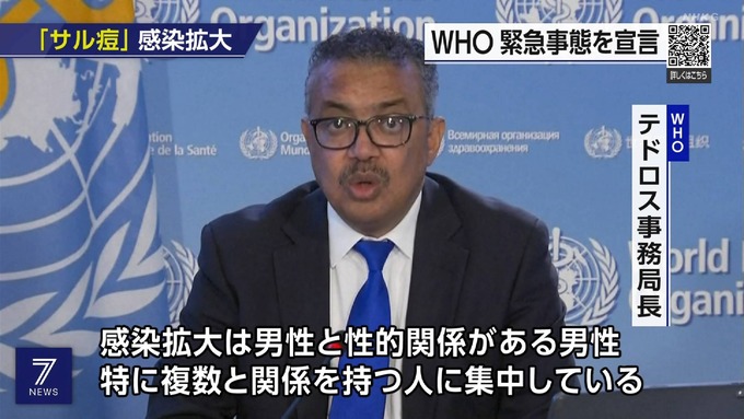 【悲報】サル痘、感染者のほとんどが男性で、260人中259人が「男性と性交渉をするゲイ」