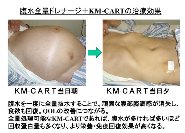 kin4