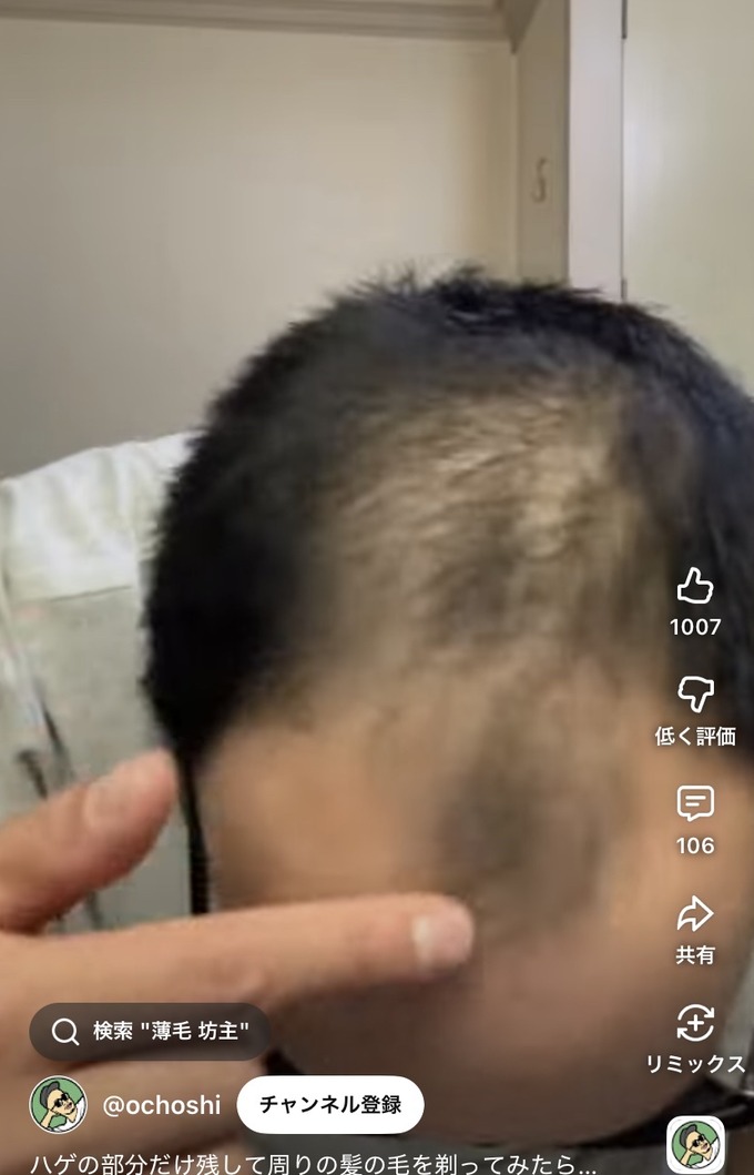 【超朗報】ハゲ、ちょっとした工夫で誤魔化せる事が判明