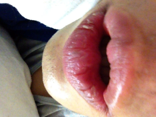 kissgao10