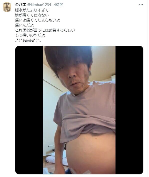 【悲報】金バエ、ついに顔が痩せこける
