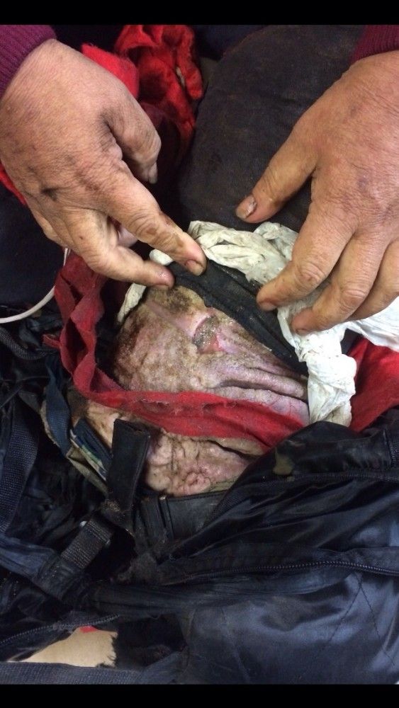 もみあげチャ シュ 超閲覧注意 左足壊死ニキ ついに左足の封印を解く ライブドアブログ もみあげチャ シュ 超閲覧注意 左足壊死ニキ ついに左足の封印を解く ライブドアブログ