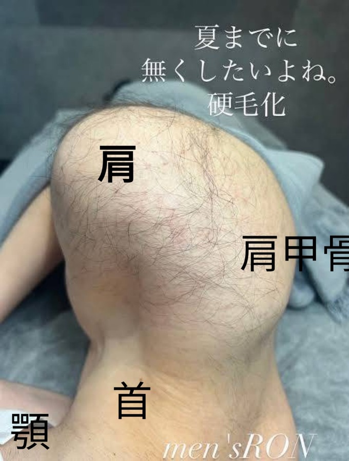 jintai4