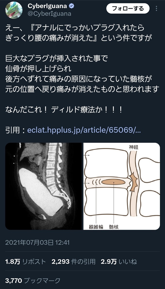 【超朗報】アナニーで腰痛が治る