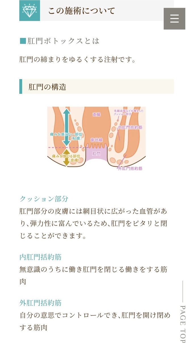 【朗報】「肛門ボトックス」が話題に