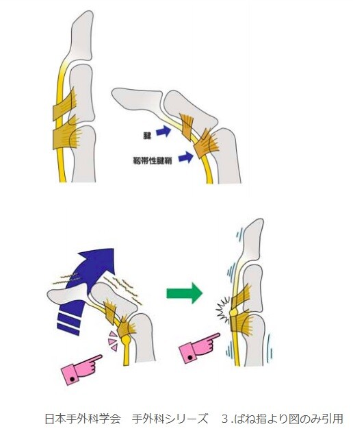 2025-02-10ばね指図解01