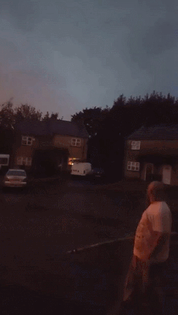 グロ注意 衝撃的なgif 右足速報