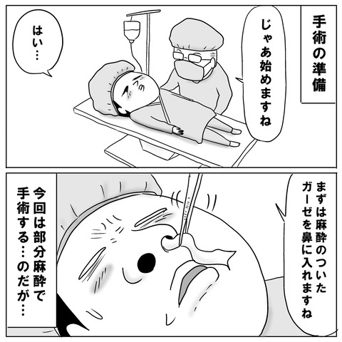鼻手術④2