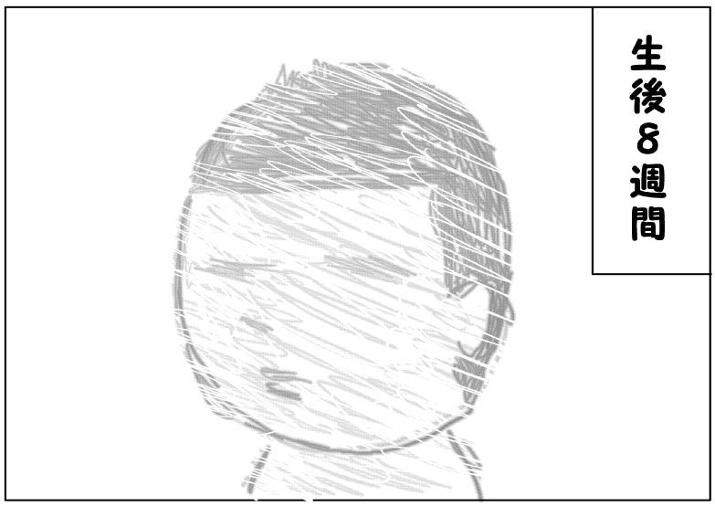 3視力