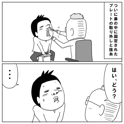 鼻手術⑨2