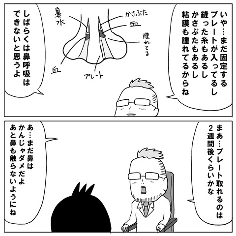鼻手術⑧9