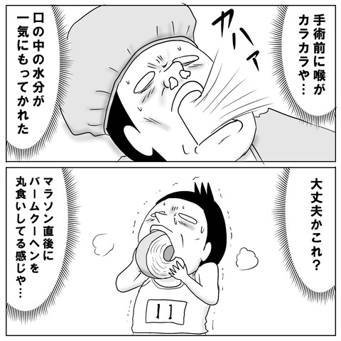 鼻手術④5