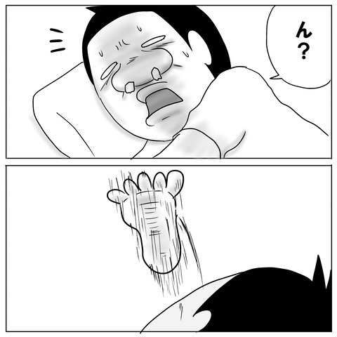 鼻手術⑦4