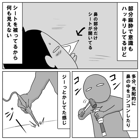 鼻手術⑤2