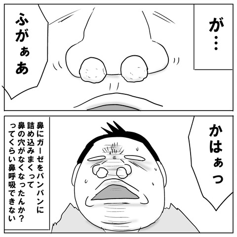 鼻手術⑤9