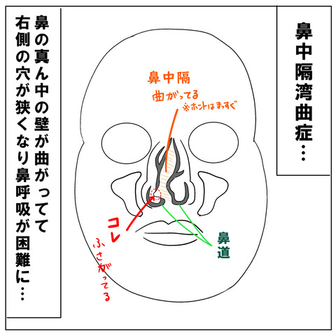 術後2