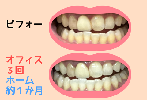 CF48B575-A388-418B-881E-C550B008CFCA
