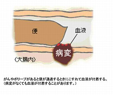 わたしは、1度、それでひっかかってさ