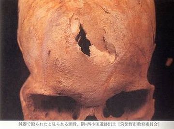 戦争で殺された弥生人の骨