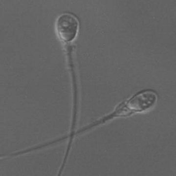精子の顕微鏡写真