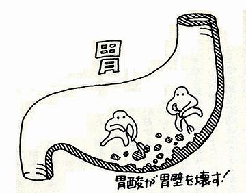 上がってきた胃酸が気管を刺激して、咳が出てたわけ?