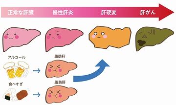 人ごとに非ず