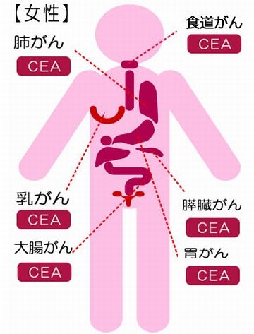 腫瘍マーカーによる、がん検診