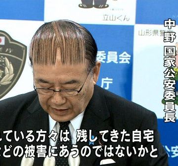 あり得ない日本のハゲ代表