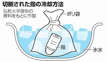 適切に冷却すれば、8時間まで再接着可能