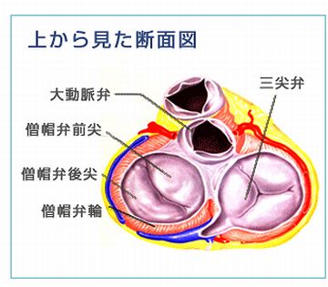 心臓エコーでは、『三尖弁逆流』