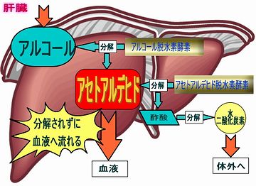 二日酔い・イメージ