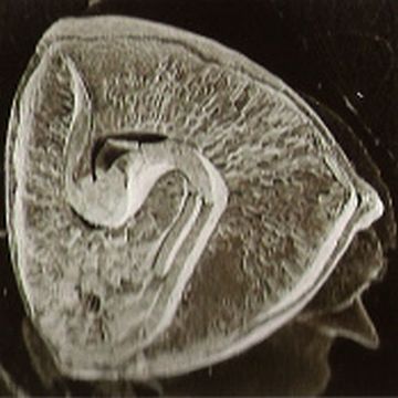 蕎麦の実の顕微鏡写真