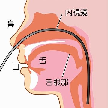 管が舌に触れないので、「オエッ」となりにくい