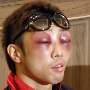 WBAミニマム級王座統一戦で井岡一翔に敗れた八重樫東
