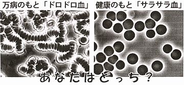 水分を取らないと、血液がドロドロになって……