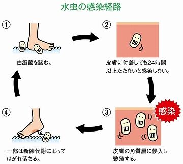 スリッパでも感染