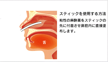 鼻からどろっとした液体を流しこまれる