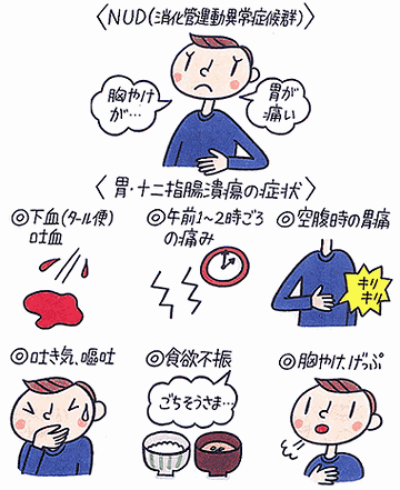 その代表格が、胃潰瘍と十二指腸潰瘍ってことね