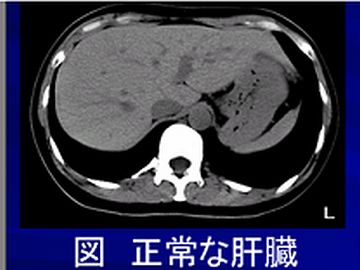 肝臓の位置では、体幹のほとんどが肝臓でした