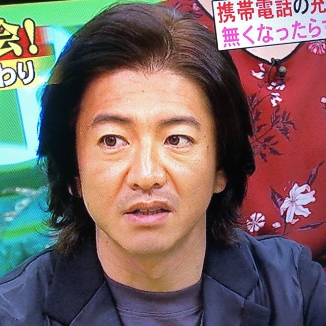 老い 木村拓哉の頭皮がヤバすぎる Miko速報