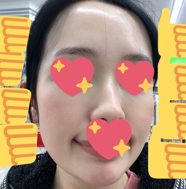 Mimiが提唱する 毛穴バランスリセット法 とは その 実践編 ベビーオイル洗顔 Mimiのインテリジェンスケア