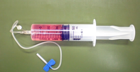 ニンニク注射 Lixil Fcマドリエ四国社友会からの快適住まいづくりレポート 社長のひとりごと