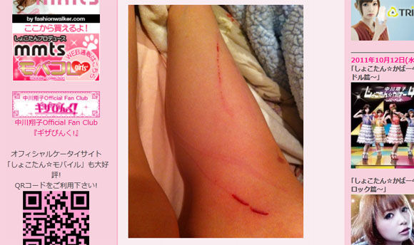 しょこたん 暴漢に襲われる 美容整形と美容外科の南クリニック 渋谷 名古屋 の独り言