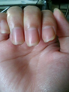 3 削れてる爪 Marriage Blue